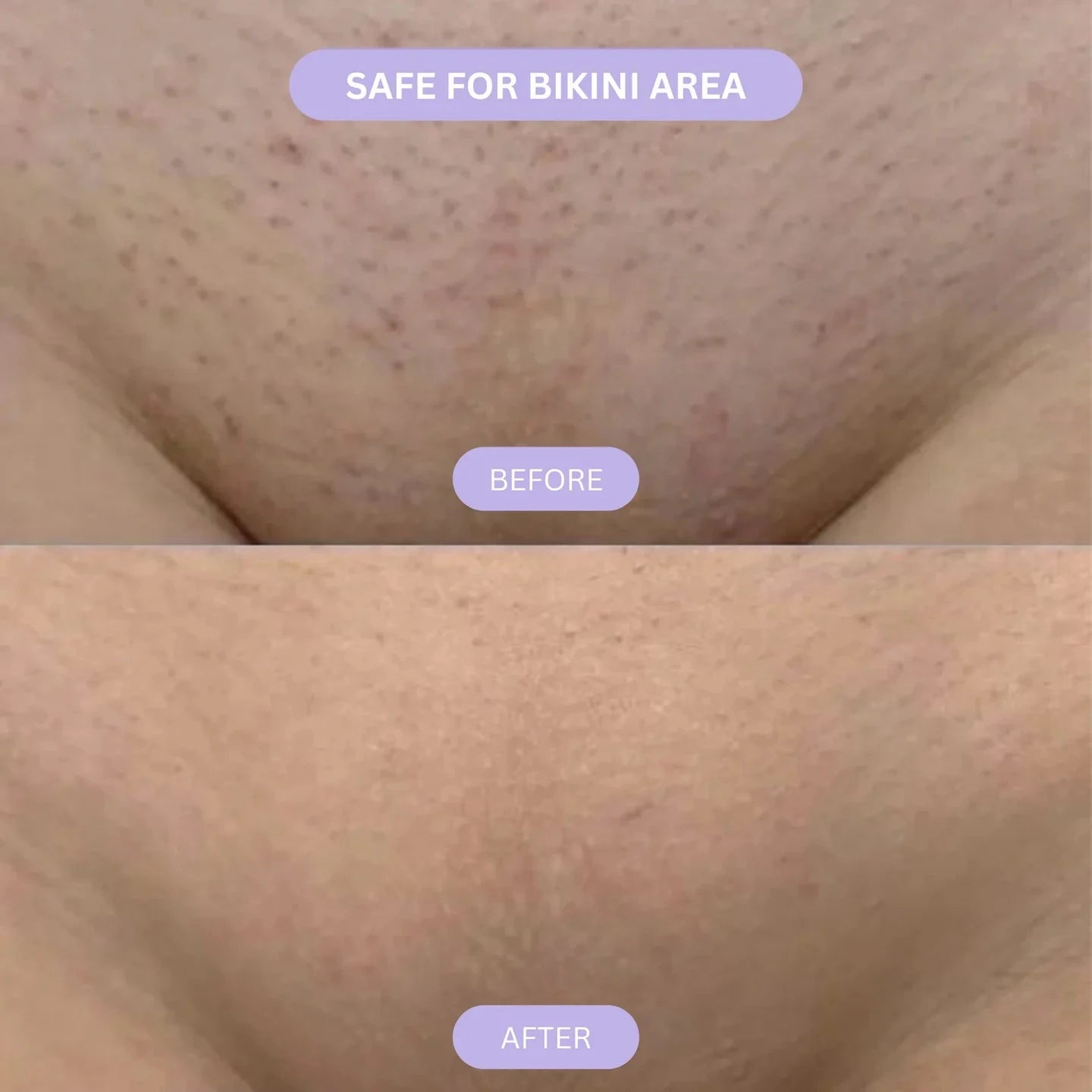 Cyperus Rotundus Skin Oil
