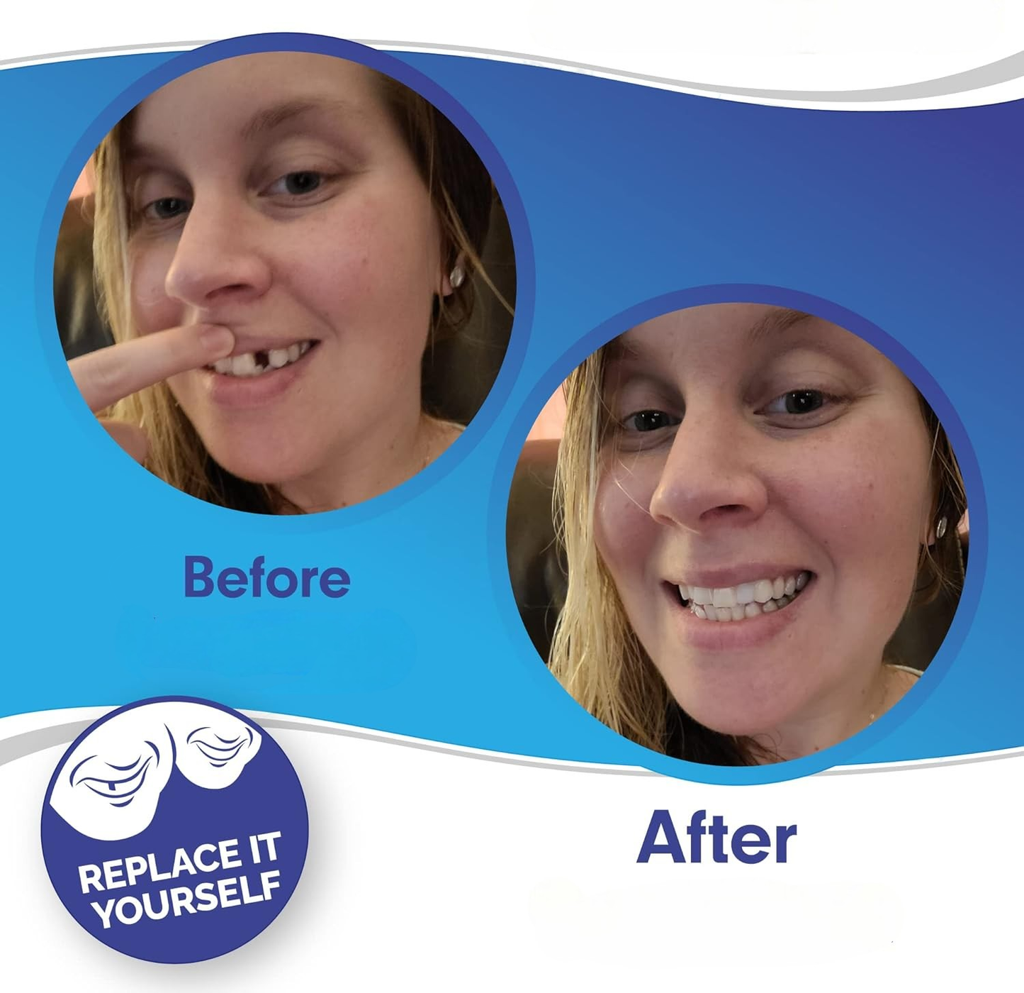 SmileFix™ False Teeth Kit