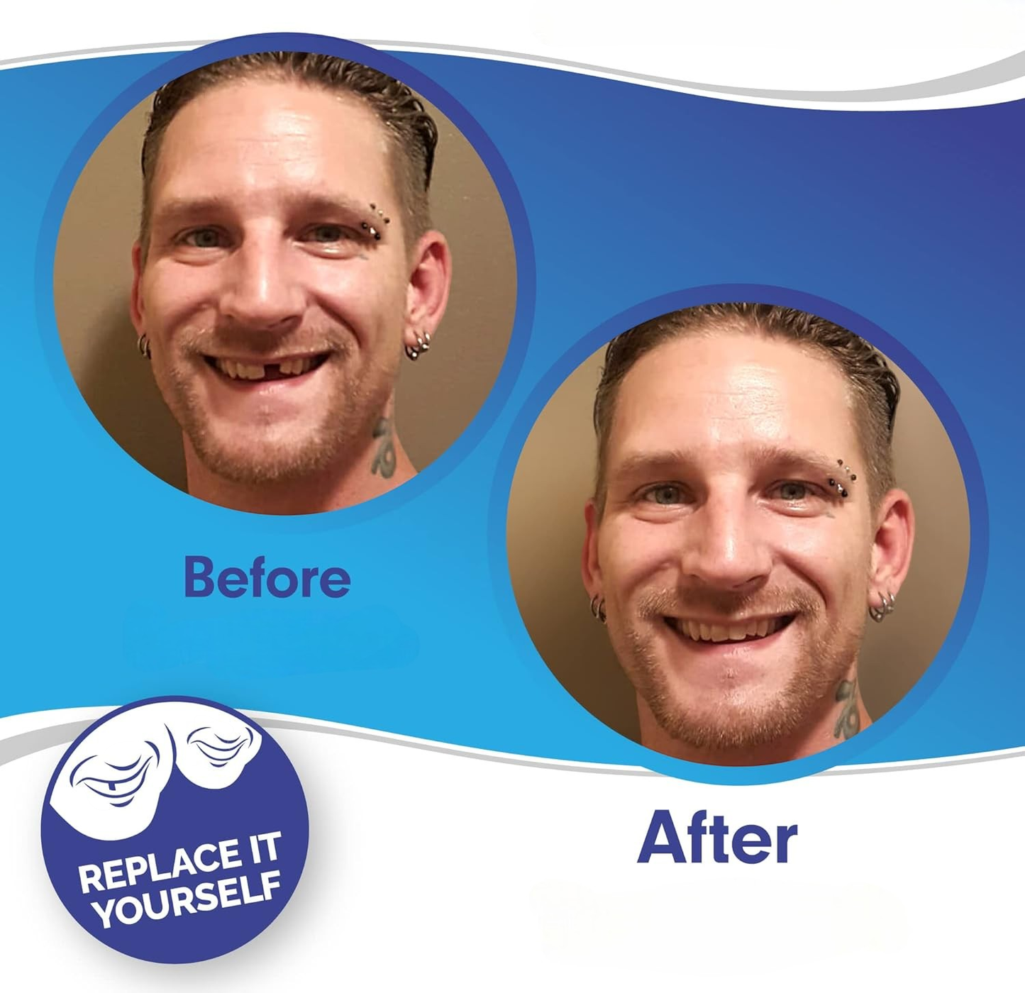 SmileFix™ False Teeth Kit