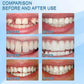 SmileFix™ False Teeth Kit