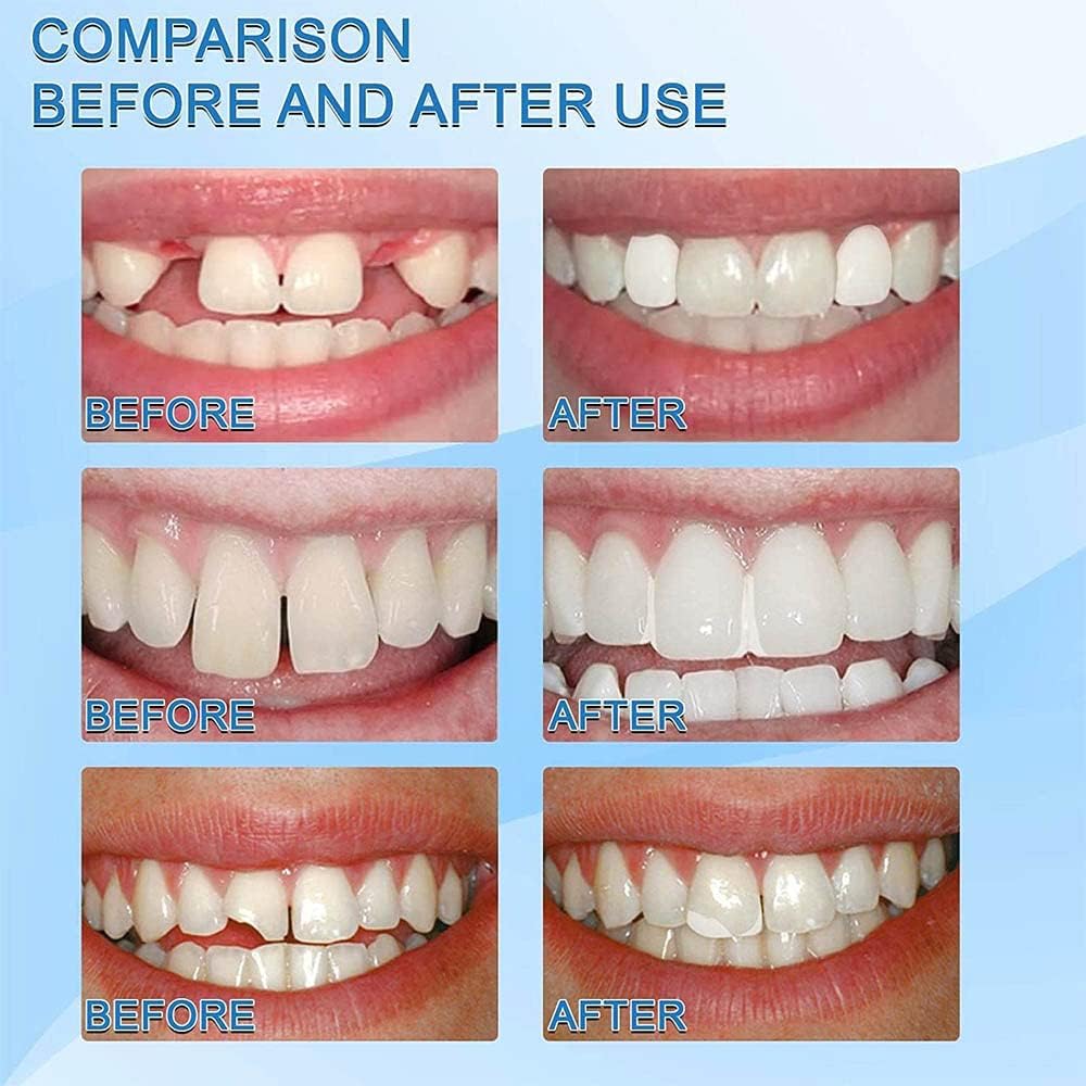 SmileFix™ False Teeth Kit