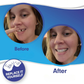 SmileFix™ False Teeth Kit